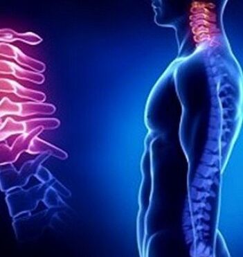 Lepoko osteokondrosia lepoko lesioek eragin dezakete